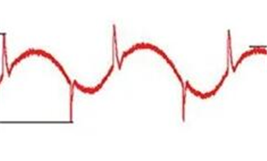 抑制开关稳压器EMI：不用滤波电路，还有什么好方法？